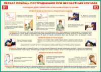 Таблица Порядок действий при опасном кровотечении 1000*1400 винил - «globural.ru» - Александров